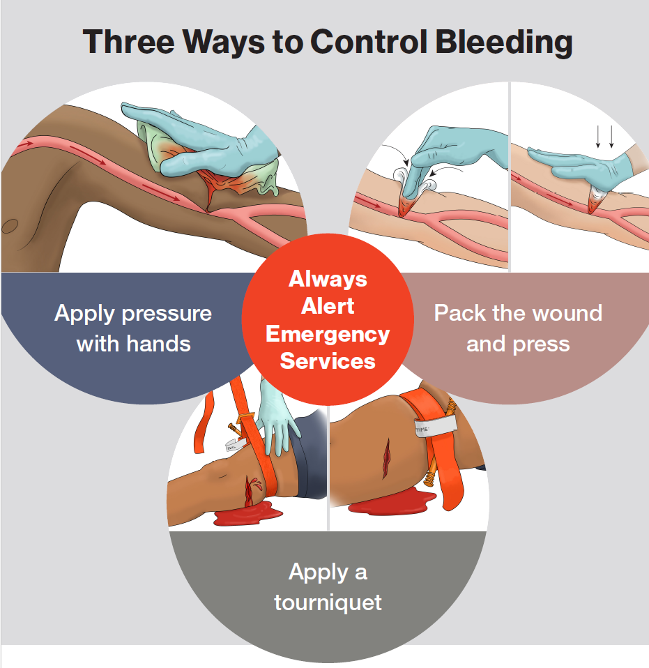 What are Some Methods of Preventing Personal Injury: Top Tips